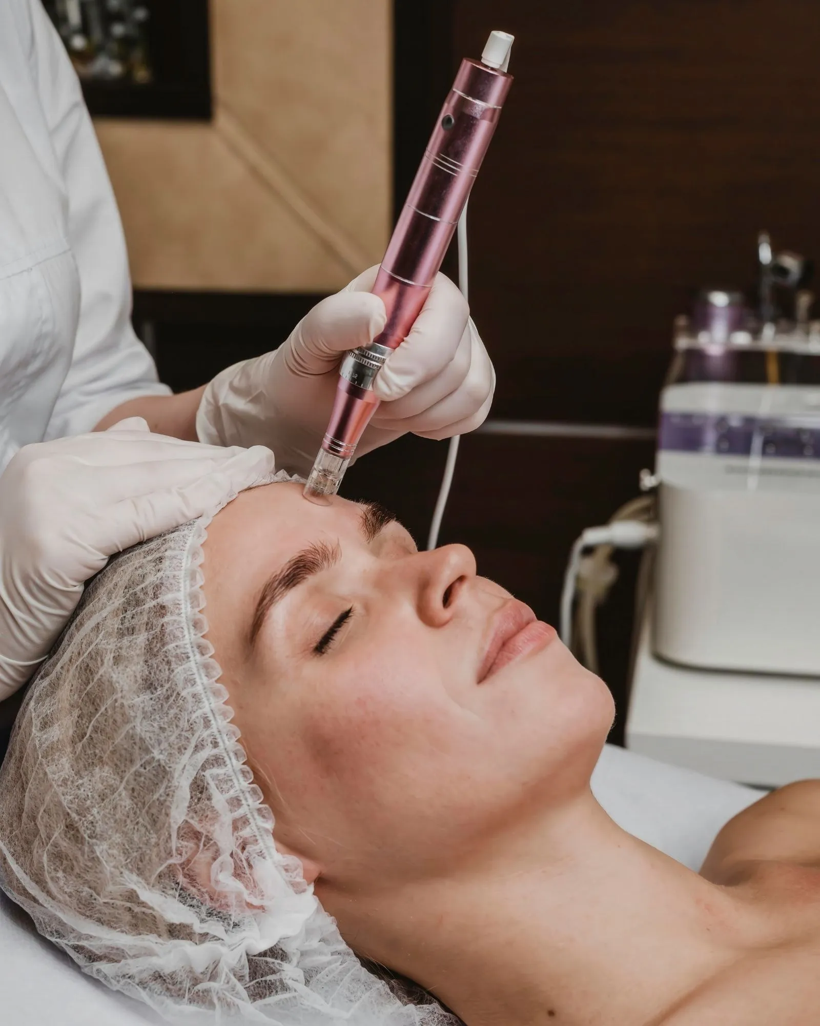 Microneedling-Behandlung: Ein Dermapen wird präzise über die Stirn geführt.